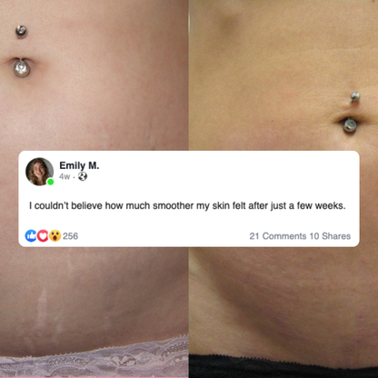 Nurtura - Nursing Pillow